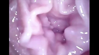 Asian Warm 12hot puberty procurement